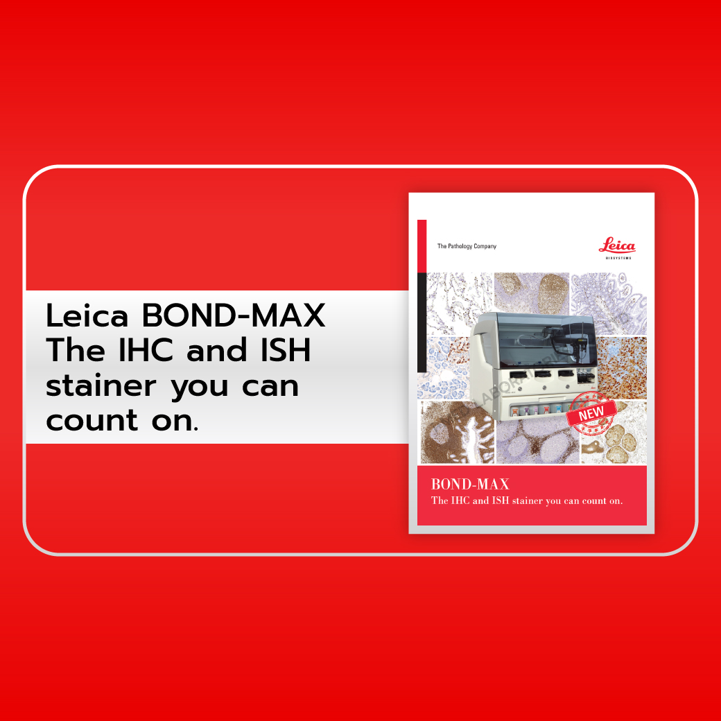 Brochure_BOND_MAX_The_IHC_and_ISH_stainer_you_can_count_on