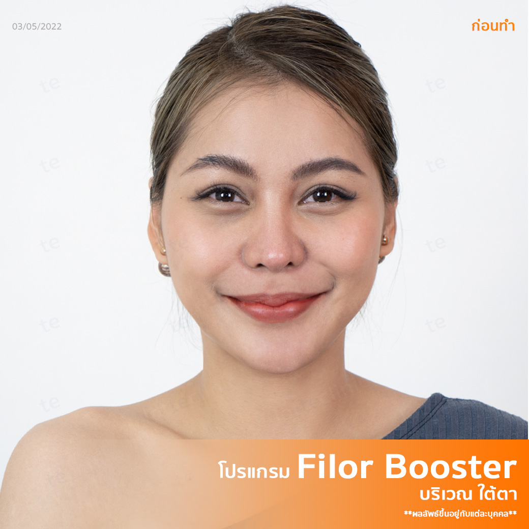 โบกมือลา...ใต้ตาคล้ำ ด้วยโปรแกรม Filor Booster