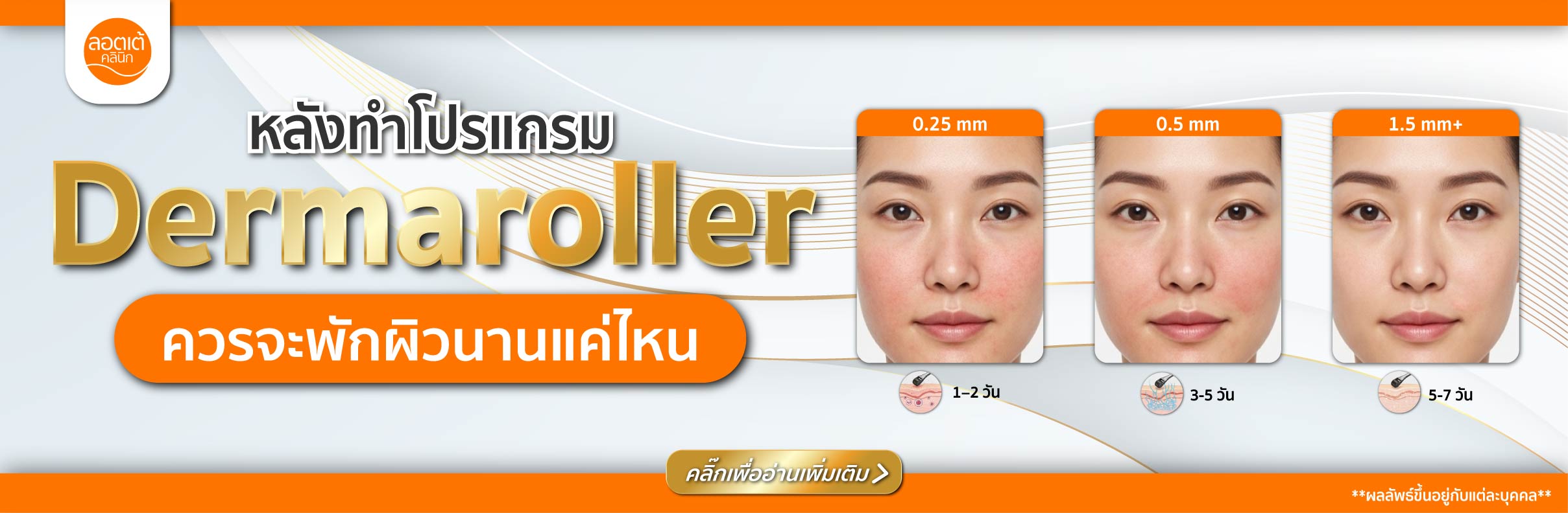 รู้จัก เวลาทอง ของผิวหลังทำโปรแกรม Dermaroller แล้วคุณจะอยากดูแลให้ถูกจุด