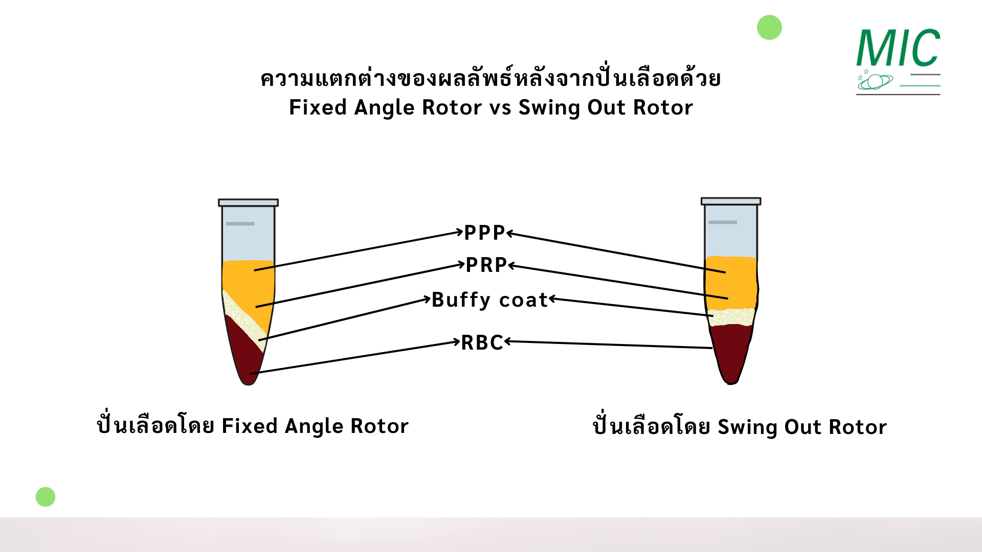 ความแตกต่างของเลือดระหว่างการปั่น Fixed Angle Rotor และ Swing Out Rotor