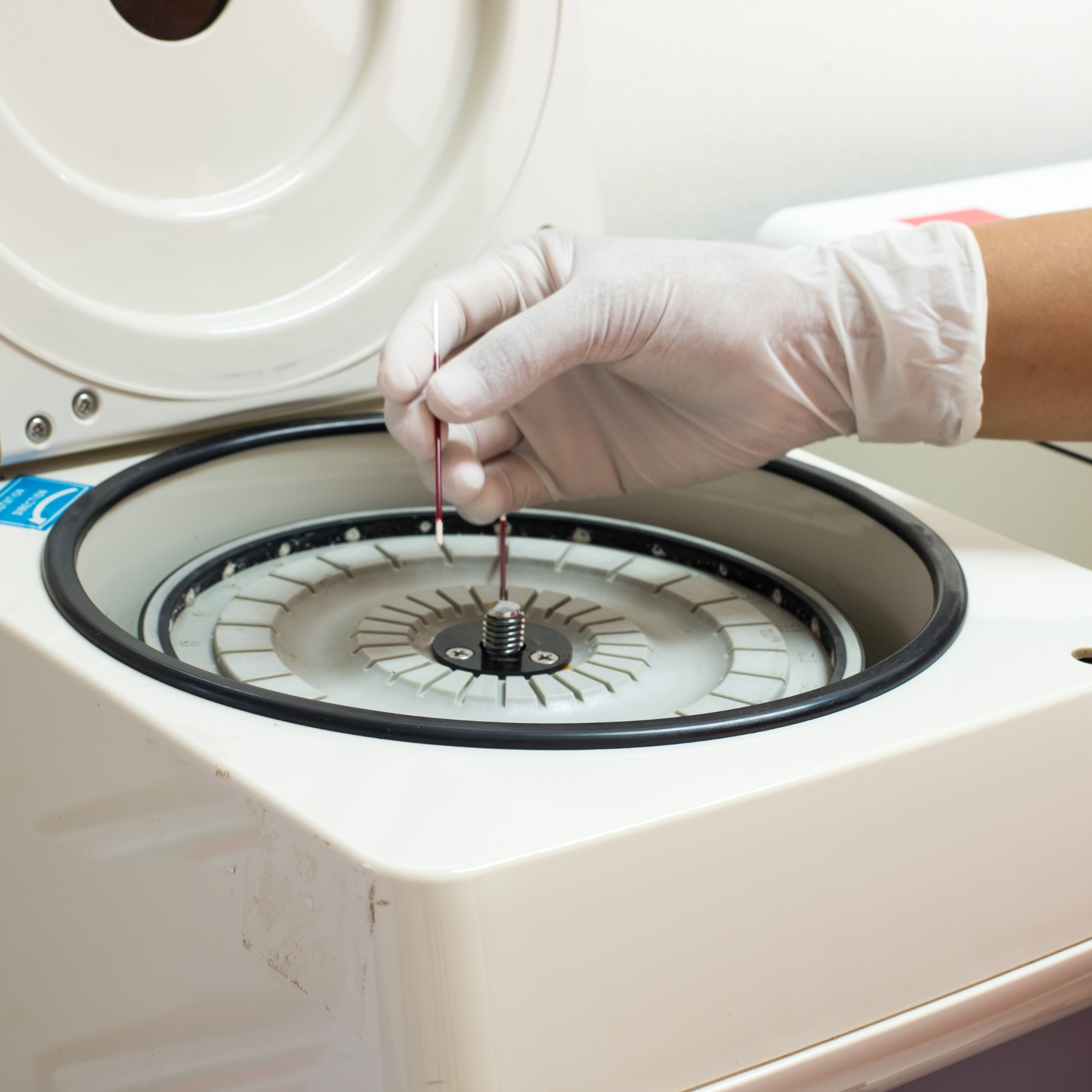 เครื่องปั่นเลือด