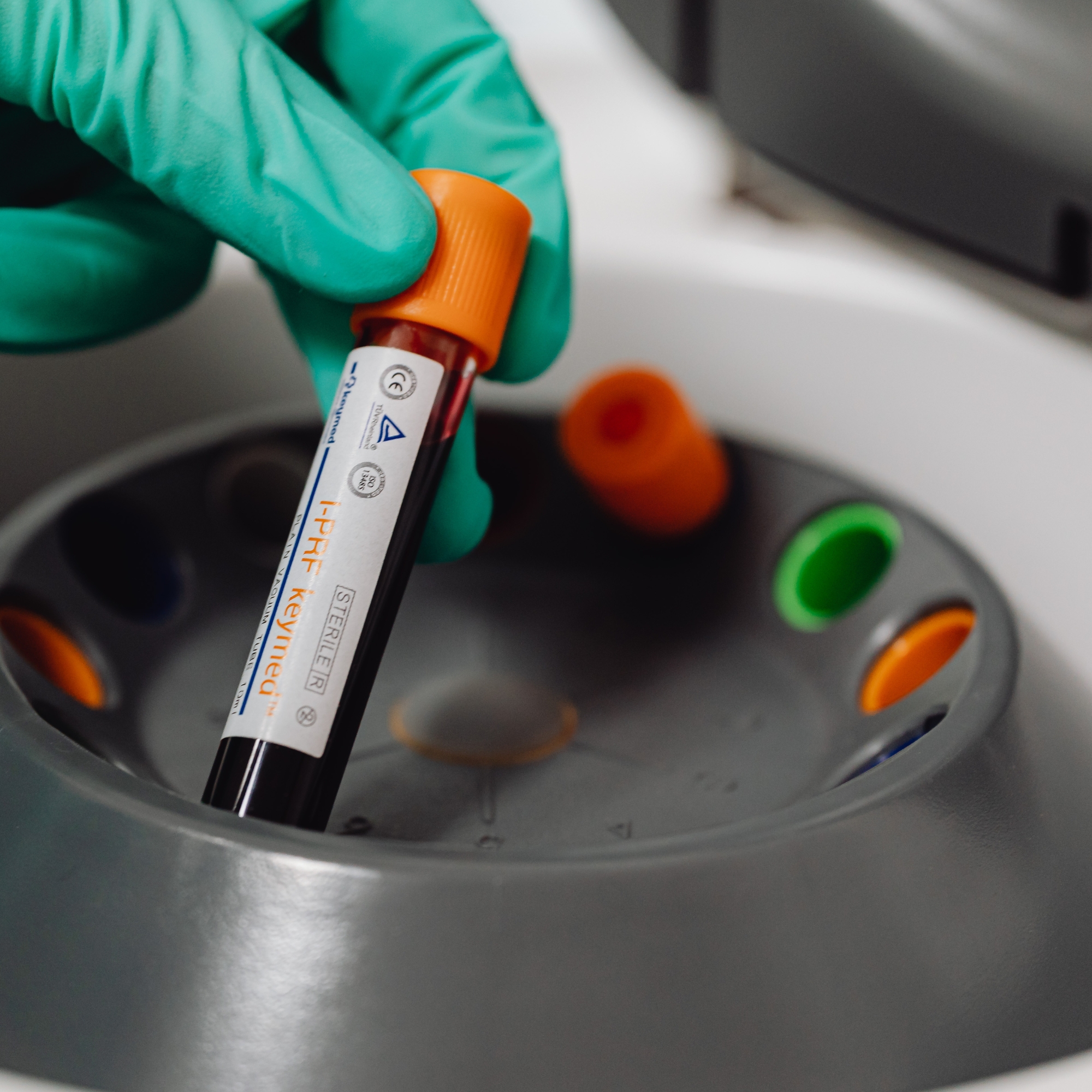 เตรียมเลือดสำหรับแยก PRP