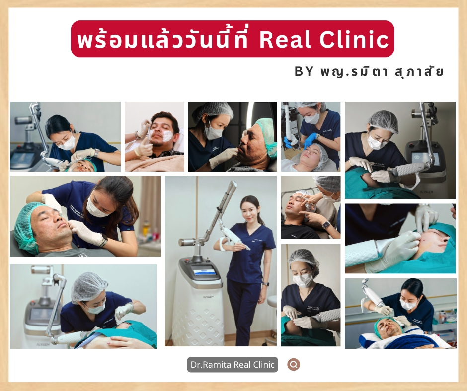 juvgen dr.jin  หลุมสิวเกาหลี ดร.จิน รักษาหลุมสิว ศัลยกรรมหลุมสิว ฟื้นฟูหลุมสิว real scar synergy dr.ramita real clinic 