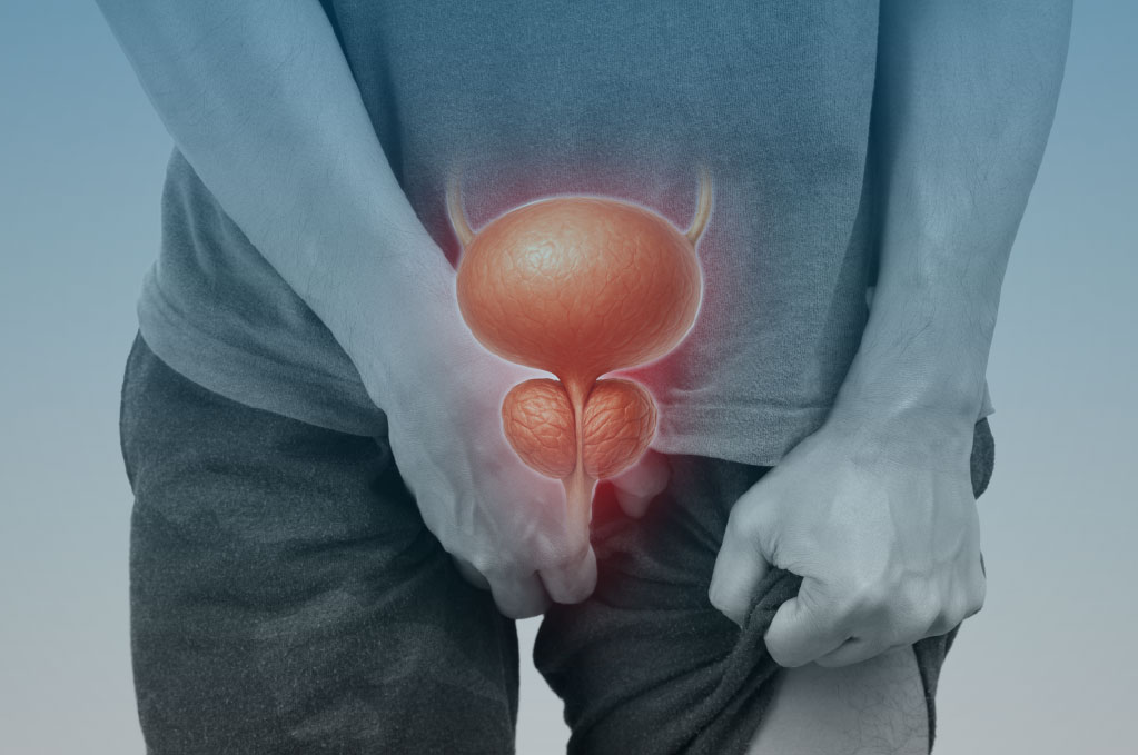 โรคต่อมลูกหมากโตหรือต่อมลูกหมากอักเสบเรื้อรัง