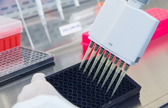 Transcriptome Sequencing  Transcriptome Sequencing