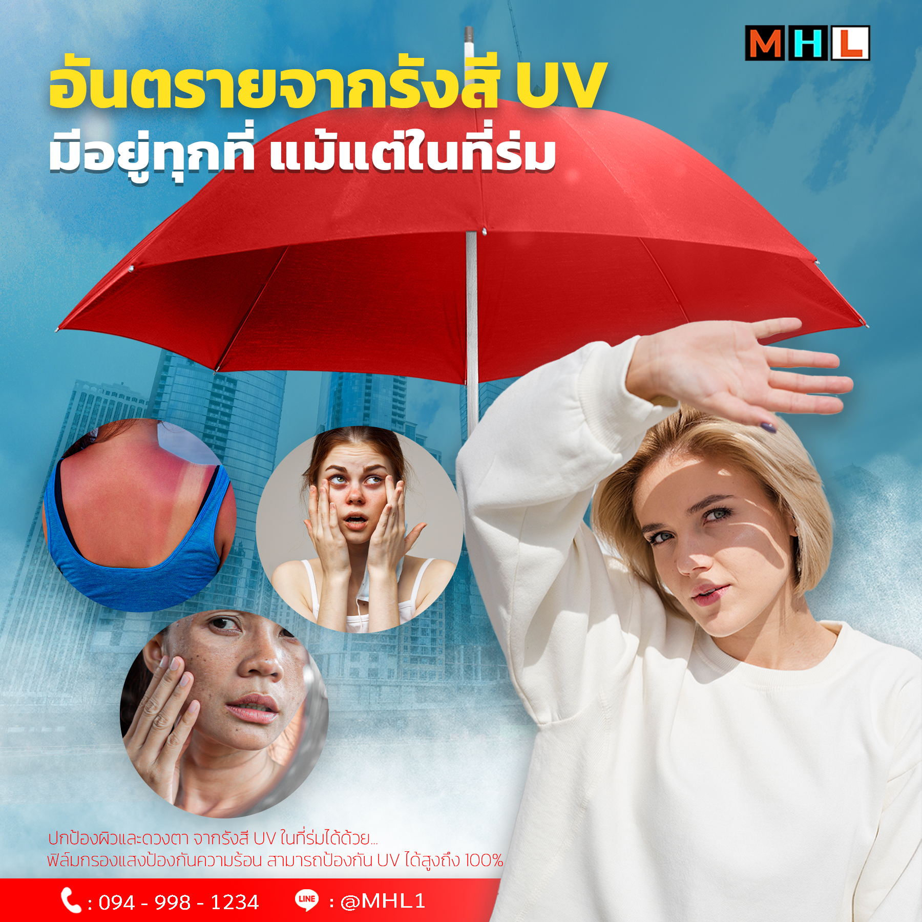 การป้องกันด้วยวิธีง่าย ๆอาจช่วยลดความเสี่ยงจากการได้รับรังสีอัลตราไวโอเลต