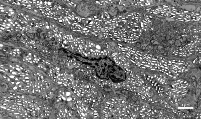 Figures2.  ultrastructure of lizard skin/30 kV/STEM