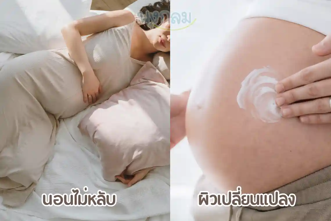 อาการคนท้องที่พบบ่อย และวิธีดูแลตัวเอง 5