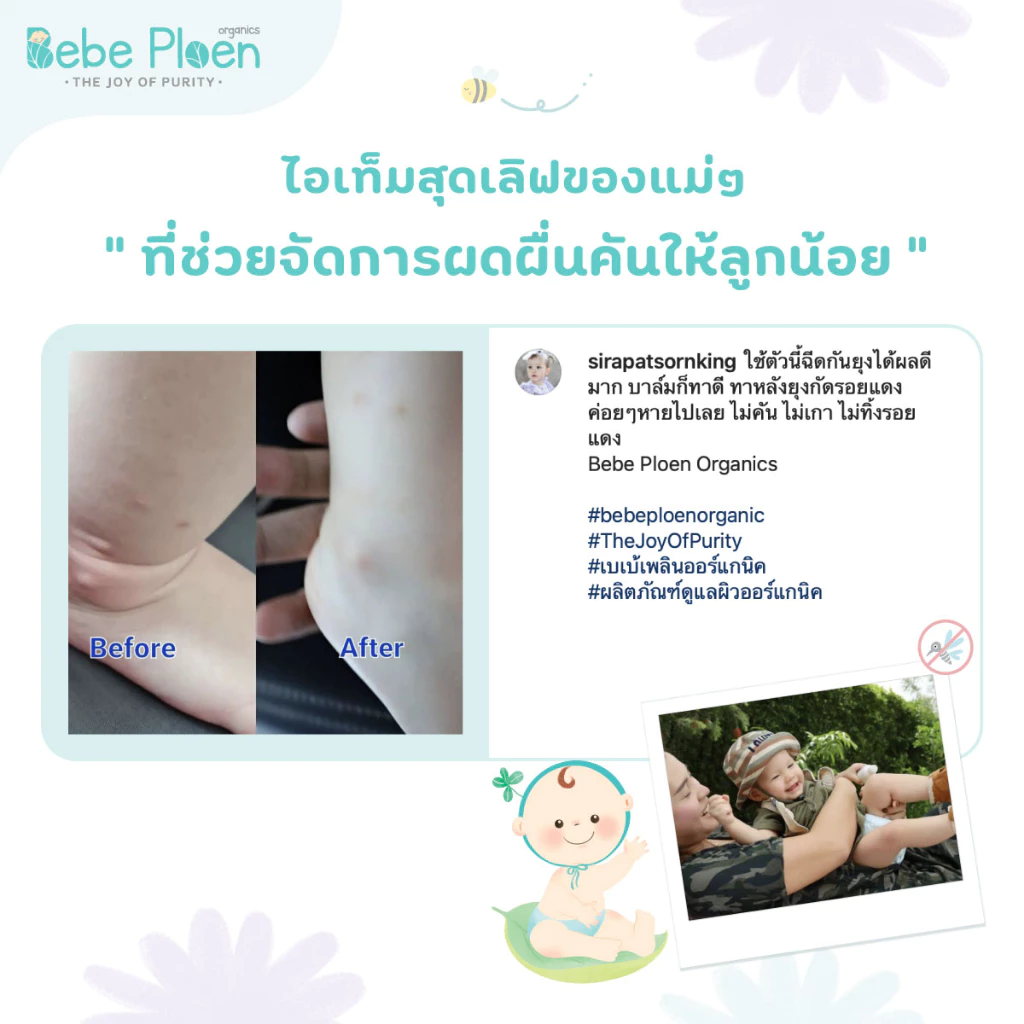 BEBE PLOEN บาล์มทาหลังยุงกัดและแมลงกัด ภาพรีวิวที่ 3 BEBE PLOEN บาล์มทาหลังยุงกัดและแมลงกัด ภาพรีวิวที่ 3