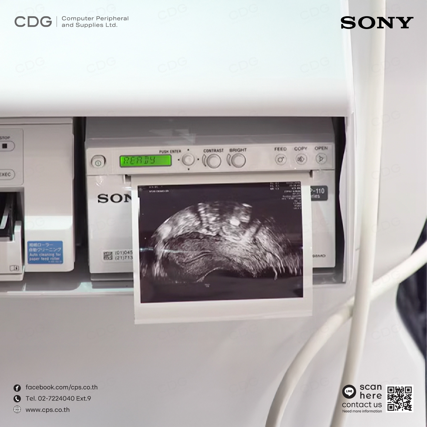 Sony UP-X898MD A6 Analogue and Digital Black and White Thermal Printer