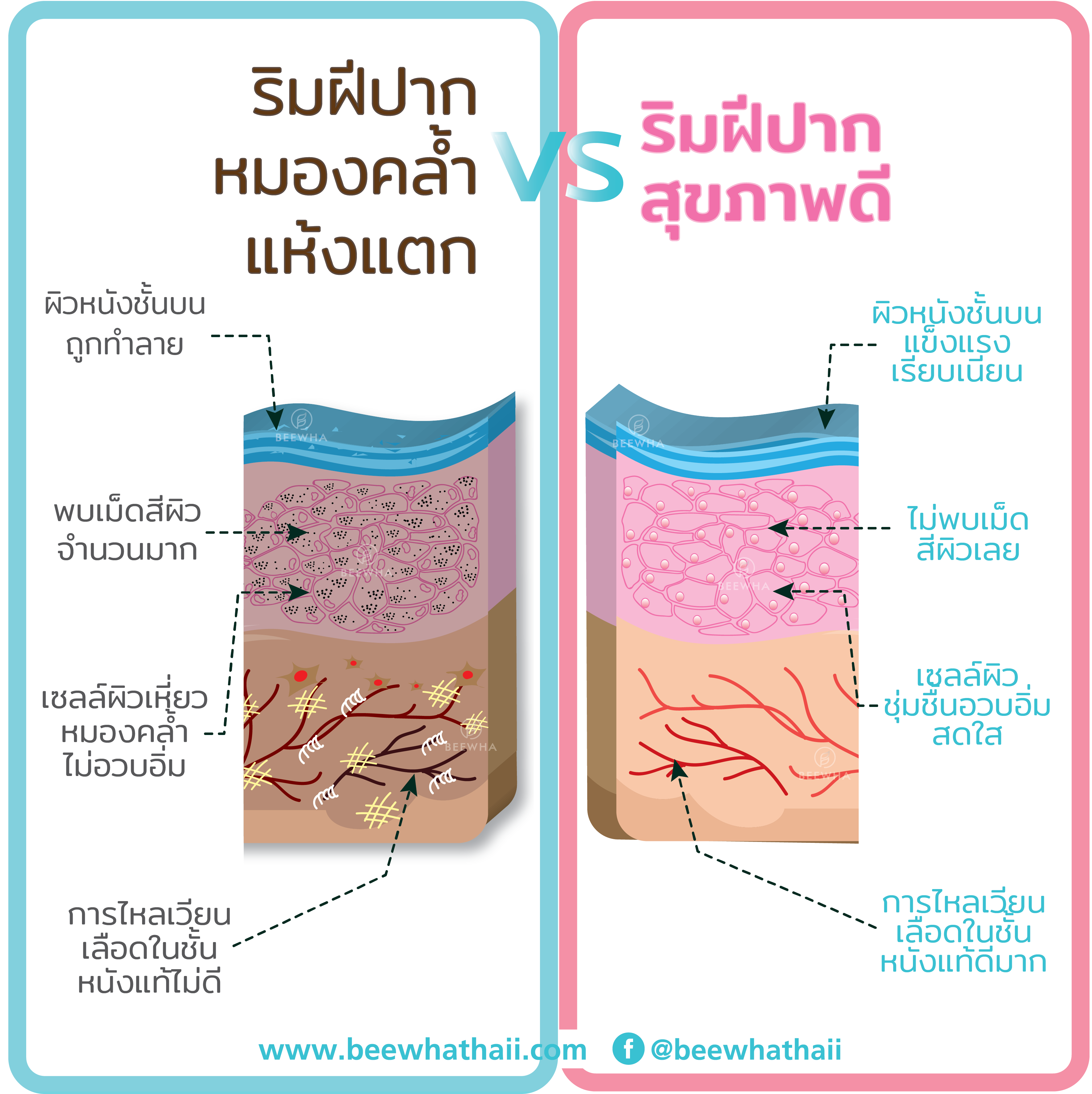 ริมฝีปากหมองคล้ำแห้งแตก vs ริมฝีปากสุขภาพดี