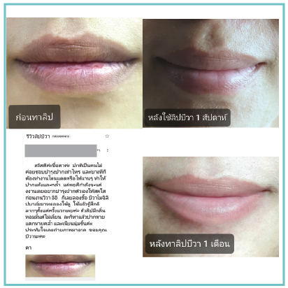 ตัวอย่างรีวิว ก่อนและหลังใช้ลิปบีวาจากคุณดา