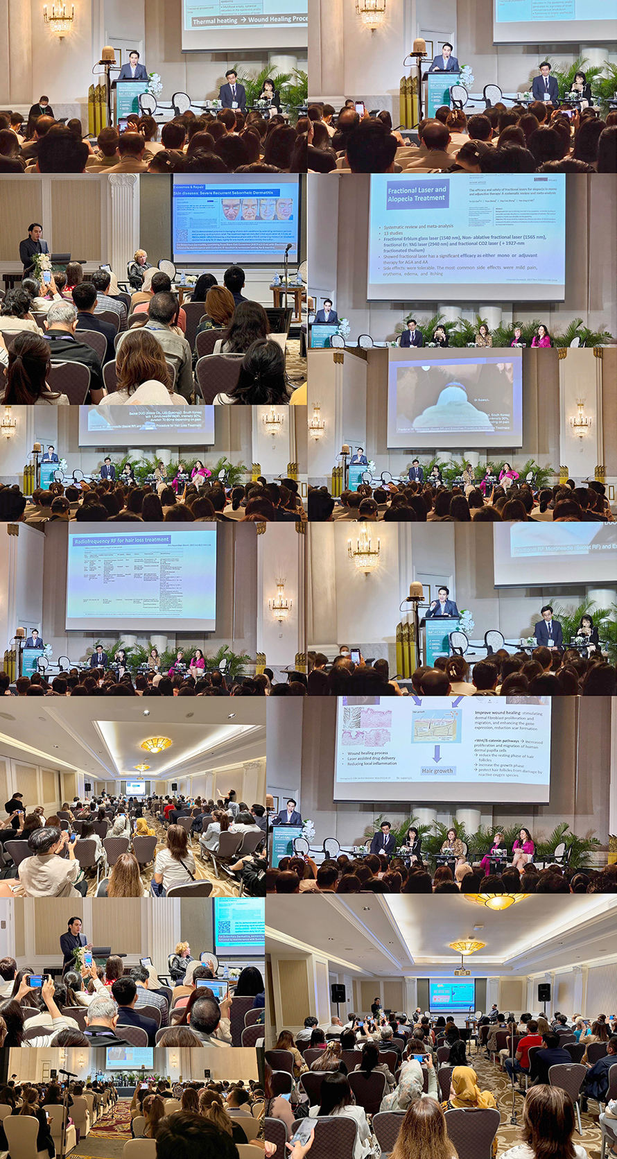 หมอรุจ ได้รับเกียรติเชิญเป็นวิทยากรบรรยายและ สาธิตการทำหัตถการ ในการประชุม IMCAS ASIA 2024 หมอรุจ ได้รับเกียรติเชิญเป็นวิทยากรบรรยายและ สาธิตการทำหัตถการ ในการประชุม IMCAS ASIA 2024