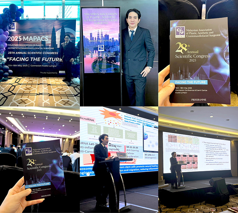 หมอรุจเป็นวิทยากรบรรยาย เทคนิครักษาหลุมสิว แผลเป็น การหายของแผล และ โปรแกรมexosomes ที่งานประชุม 2025 MAPACS: MALAYSIAN ASSOCIATION OF PLASTIC, AESTHETIC & CRANIOMAXILLOFACIAL SURGEONS 28TH ANNUAL SCIENTIFIC CONGRESS "FACING THE FUTURE” ประเทศมาเลเซียครับ หมอรุจเป็นวิทยากรบรรยาย เทคนิครักษาหลุมสิว แผลเป็น การหายของแผล และ โปรแกรมexosomes ที่งานประชุม 2025 MAPACS: MALAYSIAN ASSOCIATION OF PLASTIC, AESTHETIC & CRANIOMAXILLOFACIAL SURGEONS 28TH ANNUAL SCIENTIFIC CONGRESS "FACING THE FUTURE” ประเทศมาเลเซียครับ