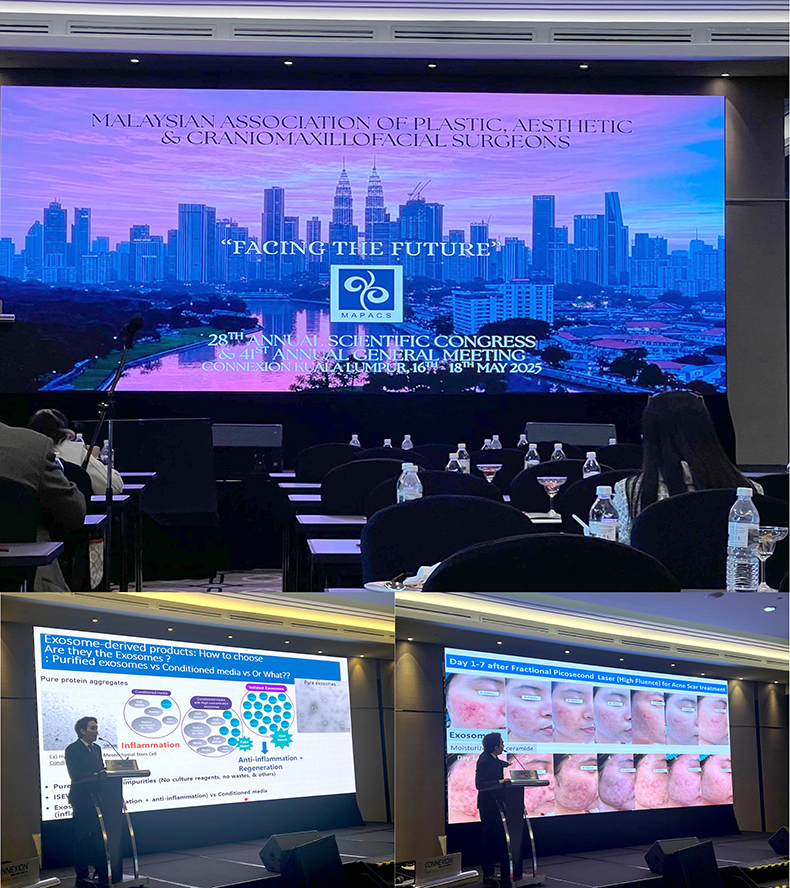 หมอรุจเป็นวิทยากรบรรยาย เทคนิครักษาหลุมสิว แผลเป็น การหายของแผล และ โปรแกรมexosomes ที่งานประชุม 2025 MAPACS: MALAYSIAN ASSOCIATION OF PLASTIC, AESTHETIC & CRANIOMAXILLOFACIAL SURGEONS 28TH ANNUAL SCIENTIFIC CONGRESS "FACING THE FUTURE” ประเทศมาเลเซียครับ หมอรุจเป็นวิทยากรบรรยาย เทคนิครักษาหลุมสิว แผลเป็น การหายของแผล และ โปรแกรมexosomes ที่งานประชุม 2025 MAPACS: MALAYSIAN ASSOCIATION OF PLASTIC, AESTHETIC & CRANIOMAXILLOFACIAL SURGEONS 28TH ANNUAL SCIENTIFIC CONGRESS "FACING THE FUTURE” ประเทศมาเลเซียครับ