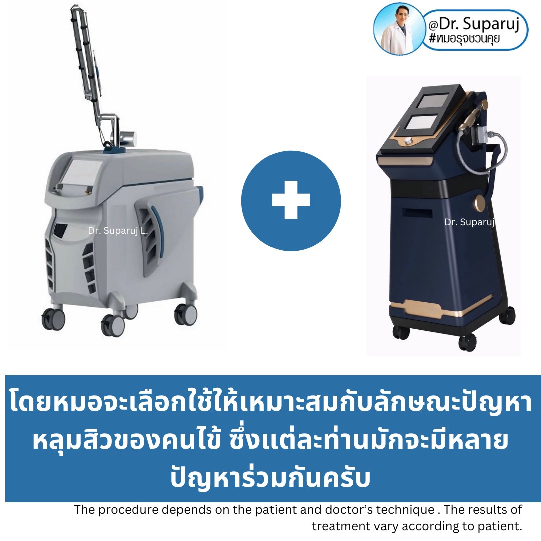 เทคนิคโปรแกรมรักษาหลุมสิว ที่หมอใช้บ่อยครับ เทคนิคโปรแกรมรักษาหลุมสิว ที่หมอใช้บ่อยครับ