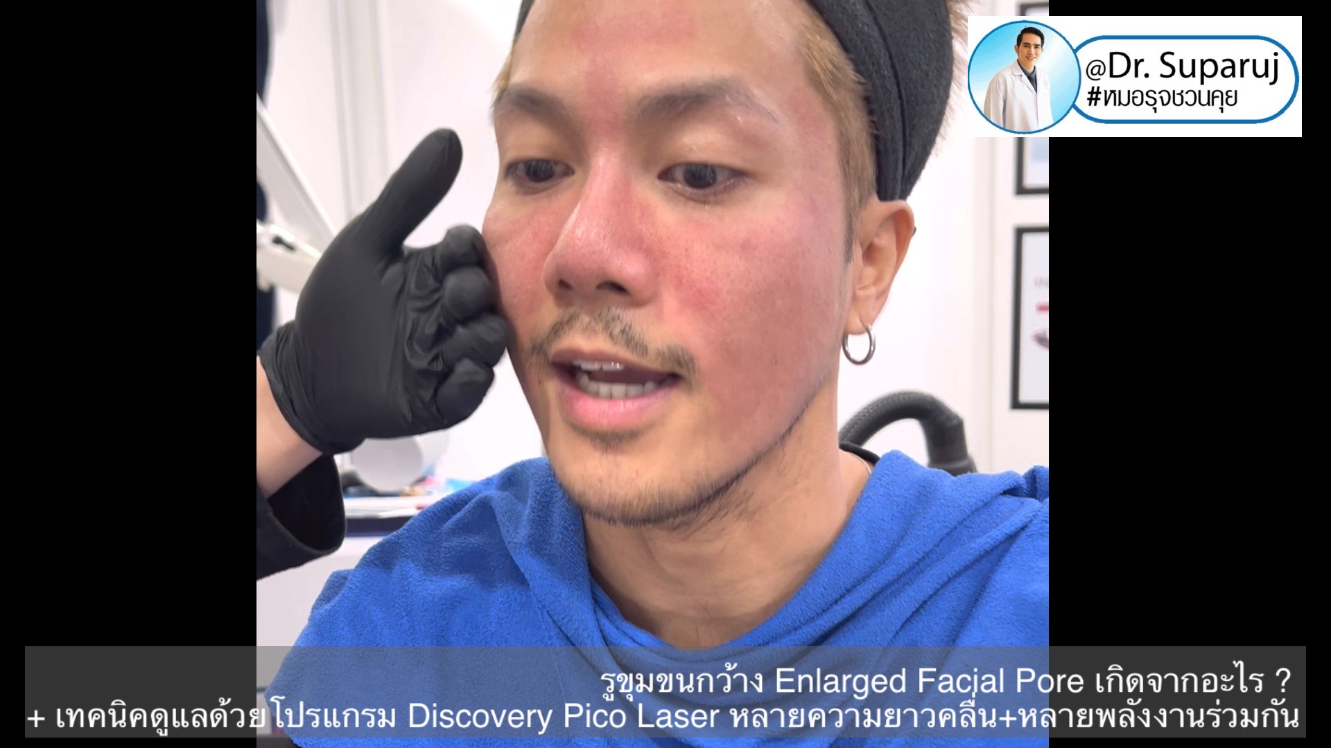 รูขุมขนกว้าง Enlarged Facial Pore เกิดจากอะไร ? + เทคนิคดูแลด้วยโปรแกรม Discovery Pico Laser หลายความยาวคลื่น +หลายพลังงานร่วมกัน