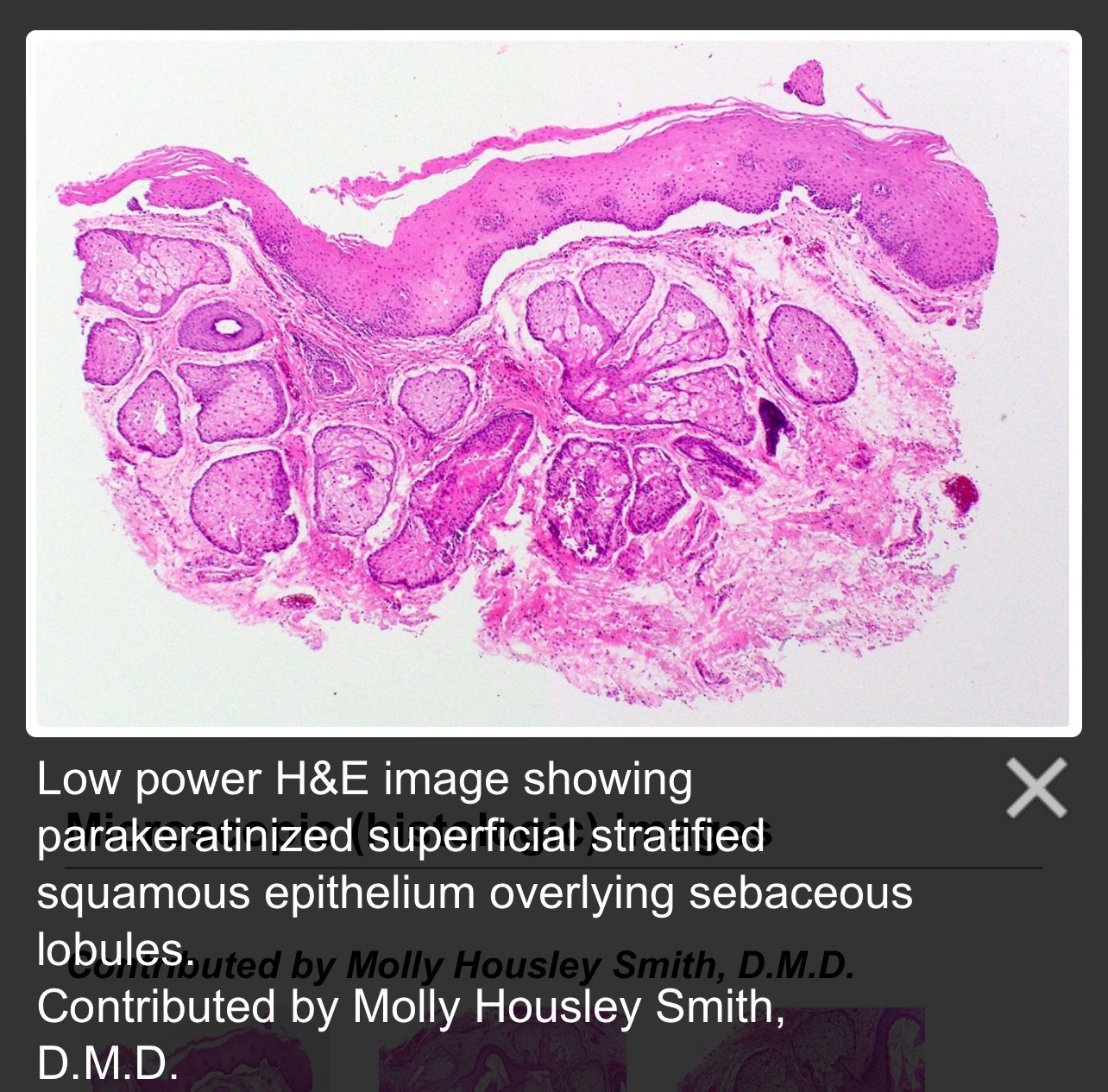 Fordyce Spot ตุ่มไขมันที่ริมฝีปาก คืออะไร มีลักษณะอย่างไร & มีวิธีดูแลได้อย่างไรบ้าง? Fordyce Spot ตุ่มไขมันที่ริมฝีปาก คืออะไร มีลักษณะอย่างไร & มีวิธีดูแลได้อย่างไรบ้าง?