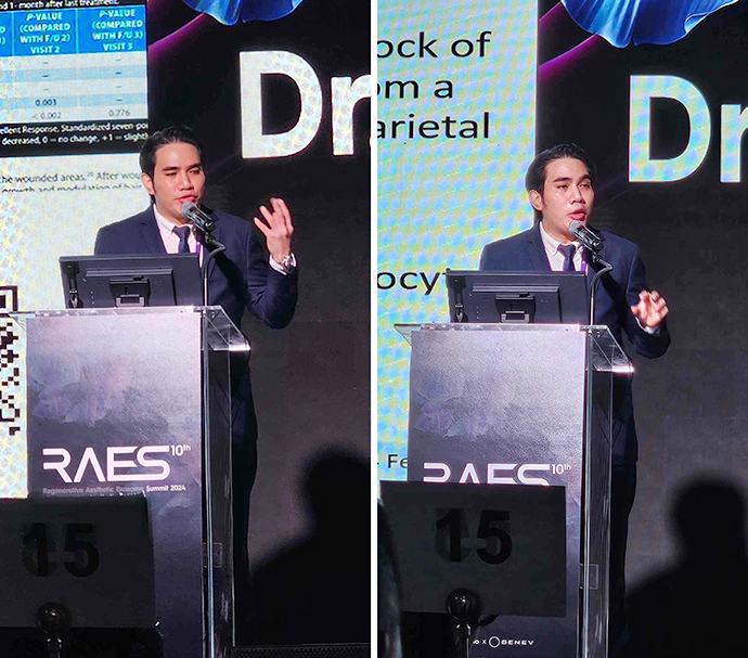 ผศ. นพ. ศุภะรุจ เลื่องอรุณ รู้สึกเป็นเกียรติอย่างมากที่ได้มีโอกาสร่วมบรรยายและได้รับรางวัลจากงานประชุมวิชาการด้าน Extracellular vesicle: RAES 2024 ครั้งที่ 10 (Regenerative Aesthetic Exosome Summit Korea 2024) ณ กรุงโซล ประเทศเกาหลีใต้ 2024 ที่กรุงโซล ประเทศเกาหลี ผศ. นพ. ศุภะรุจ เลื่องอรุณ รู้สึกเป็นเกียรติอย่างมากที่ได้มีโอกาสร่วมบรรยายและได้รับรางวัลจากงานประชุมวิชาการด้าน Extracellular vesicle: RAES 2024 ครั้งที่ 10 (Regenerative Aesthetic Exosome Summit Korea 2024) ณ กรุงโซล ประเทศเกาหลีใต้ 2024 ที่กรุงโซล ประเทศเกาหลี