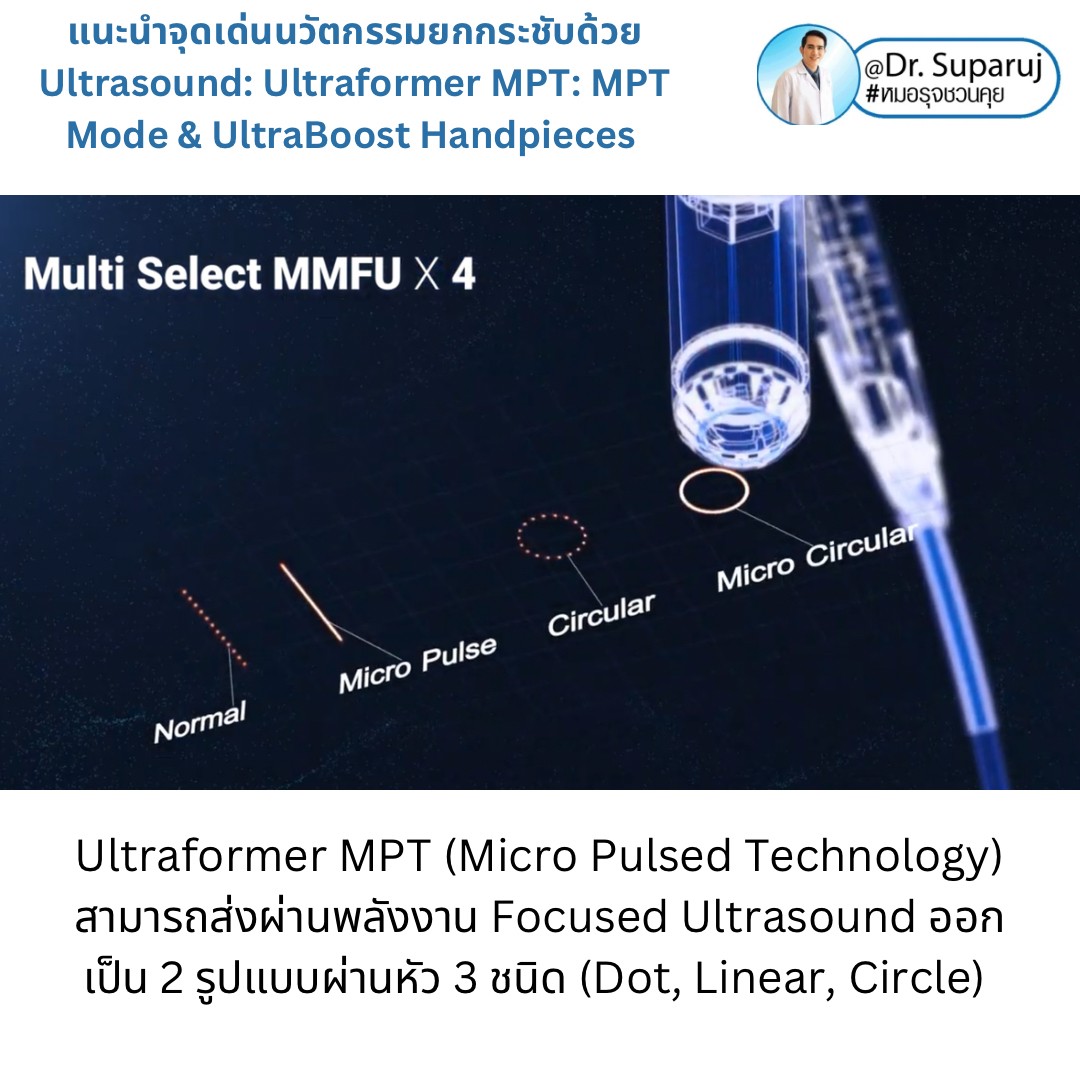 แนะนำนวัตกรรม พลังงานเครื่องเสียง Macro & Micro Focused Ultrasound ยกกระชับผิว Ultraformer MPT: จุดเด่น + ทดสอบลักษณะพลังงาน + การประเมินลักษณะผิว ให้เห็นกันชัดๆเลยครับ แนะนำนวัตกรรม พลังงานเครื่องเสียง Macro & Micro Focused Ultrasound ยกกระชับผิว Ultraformer MPT: จุดเด่น + ทดสอบลักษณะพลังงาน + การประเมินลักษณะผิว ให้เห็นกันชัดๆเลยครับ