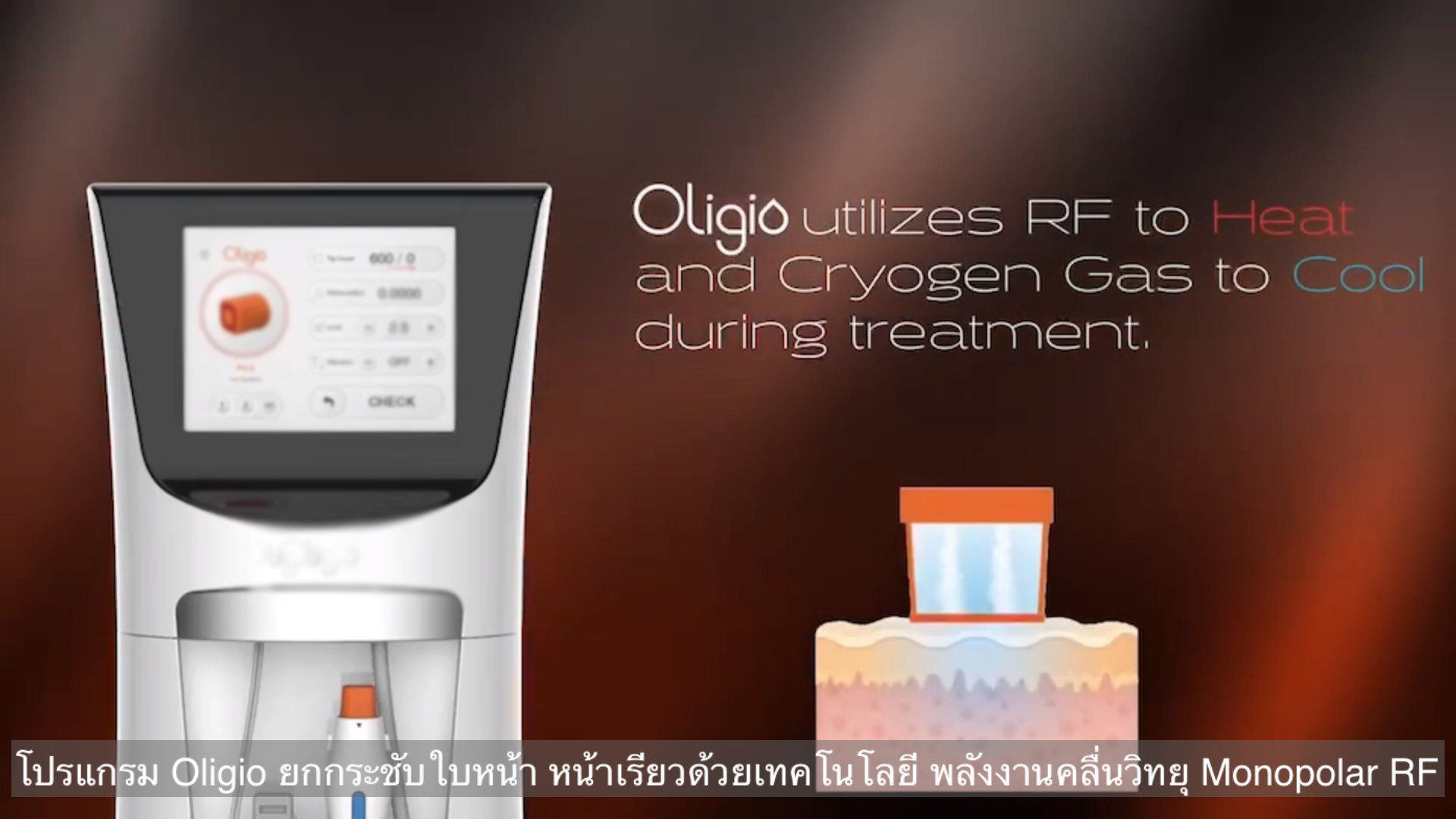 ยกกระชับผิวหน้าด้วย โปรแกรม Oligio Monopolar RF มีกลไก& จุดเด่น อย่างไร ? ยกกระชับผิวหน้าด้วย โปรแกรม Oligio Monopolar RF มีกลไก& จุดเด่น อย่างไร ?