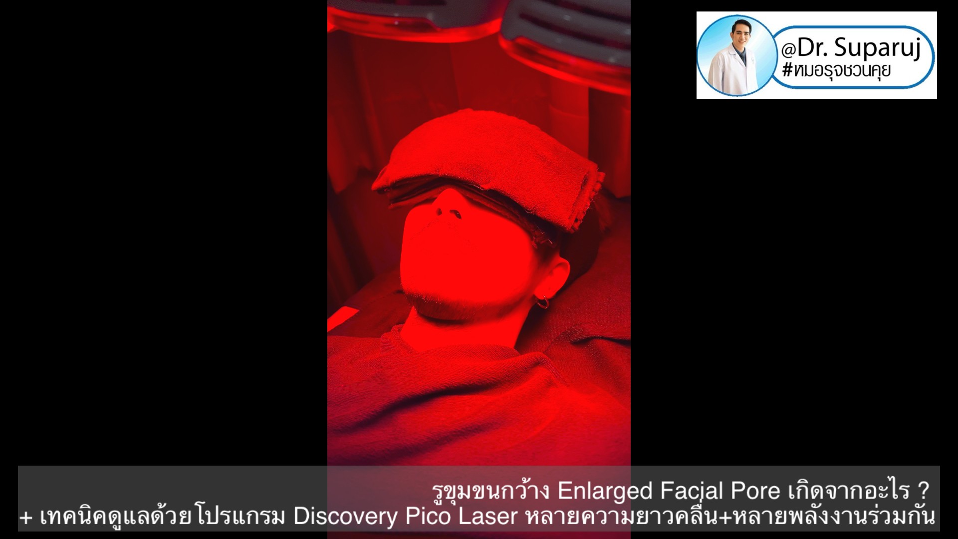 รูขุมขนกว้าง Enlarged Facial Pore เกิดจากอะไร ? + เทคนิคดูแลด้วยโปรแกรม Discovery Pico Laser หลายความยาวคลื่น +หลายพลังงานร่วมกัน