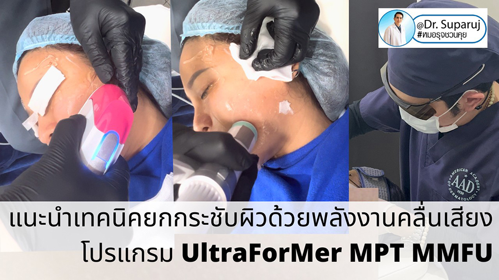 แนะนำเทคนิคยกกระชับผิว ด้วยพลังงานคลื่นเสียง MMFU Focused Ultrasound โปรแกรม Ultraformer MPT แนะนำเทคนิคยกกระชับผิว ด้วยพลังงานคลื่นเสียง MMFU Focused Ultrasound โปรแกรม Ultraformer MPT