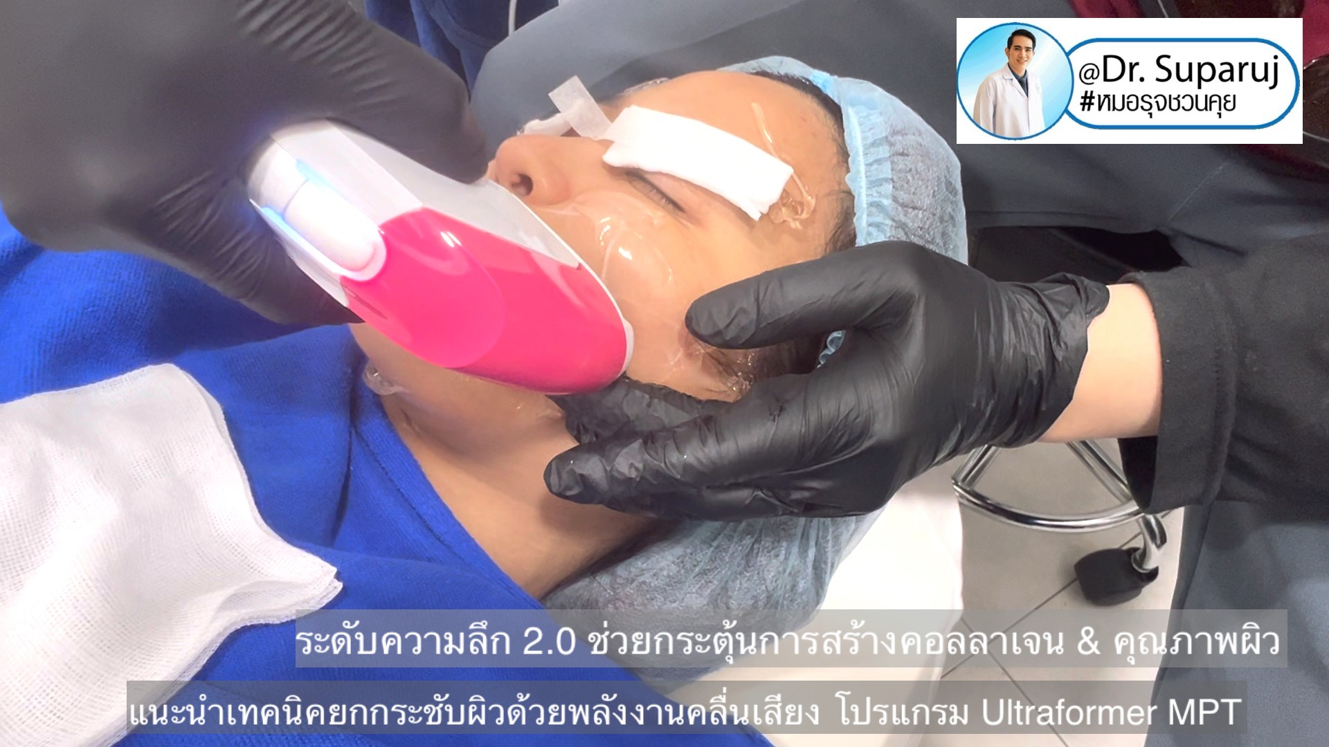 แนะนำเทคนิคยกกระชับผิว ด้วยพลังงานคลื่นเสียง MMFU Focused Ultrasound โปรแกรม Ultraformer MPT