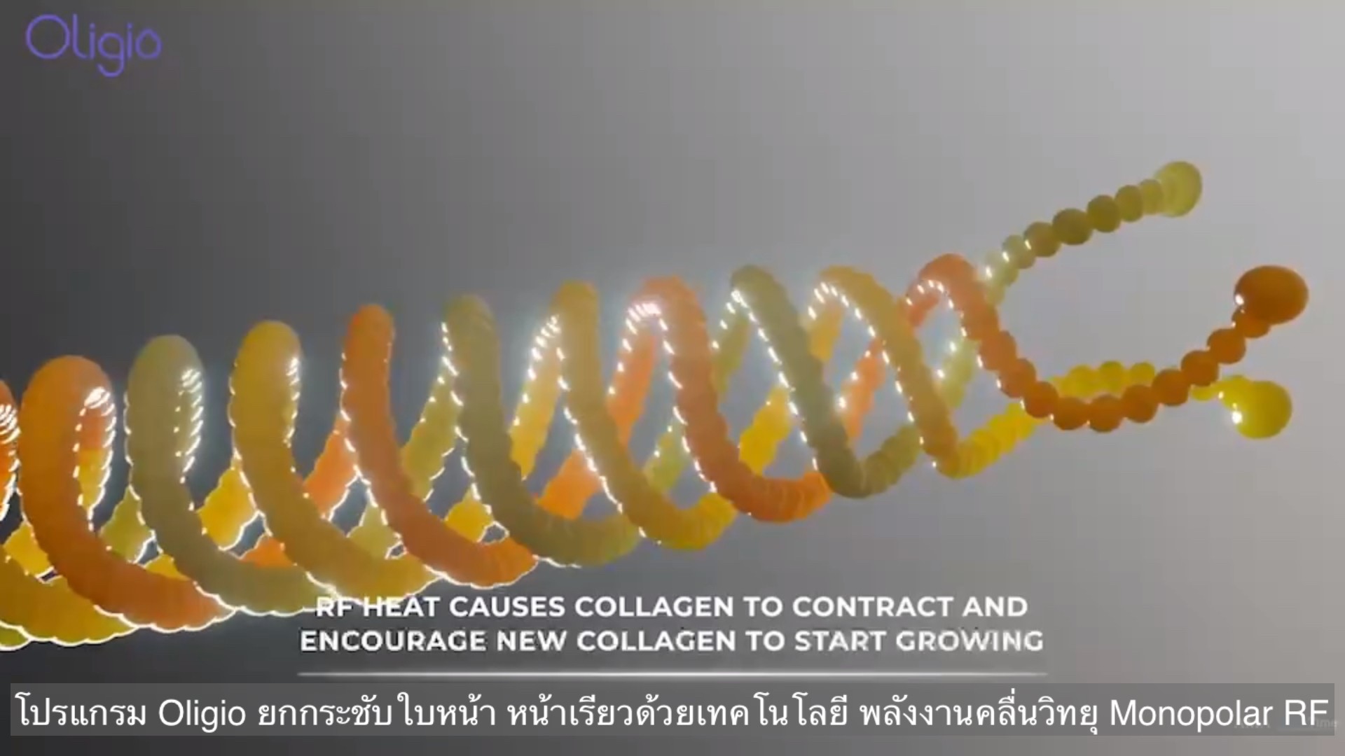 ยกกระชับผิวหน้าด้วย โปรแกรม Oligio Monopolar RF มีกลไก& จุดเด่น อย่างไร ? ยกกระชับผิวหน้าด้วย โปรแกรม Oligio Monopolar RF มีกลไก& จุดเด่น อย่างไร ?