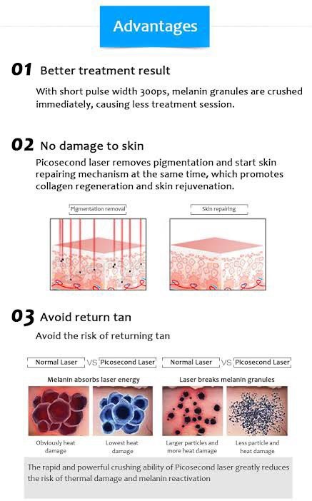 แนะนำเทคนิคเลเซอร์ลบรอยสักด้วย Picosecond Laser: ลบรอยสักด้วยเลเซอร์ Discovery Picosecond Laser มีเทคนิคอย่างไร ? แนะนำเทคนิคเลเซอร์ลบรอยสักด้วย Picosecond Laser: ลบรอยสักด้วยเลเซอร์ Discovery Picosecond Laser มีเทคนิคอย่างไร ?