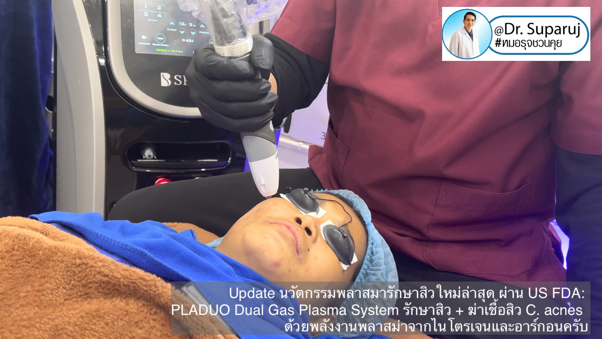 Update นวัตกรรมพลาสมารักษาสิวใหม่ล่าสุด ผ่าน US FDA: PLADUO Dual Gas Plasma System ช่วยรักษาสิว + ฆ่าเชื้อสิว C. acnes + รักษาหลุมสิว รอยดำ รอยแดง Update นวัตกรรมพลาสมารักษาสิวใหม่ล่าสุด ผ่าน US FDA: PLADUO Dual Gas Plasma System ช่วยรักษาสิว + ฆ่าเชื้อสิว C. acnes + รักษาหลุมสิว รอยดำ รอยแดง