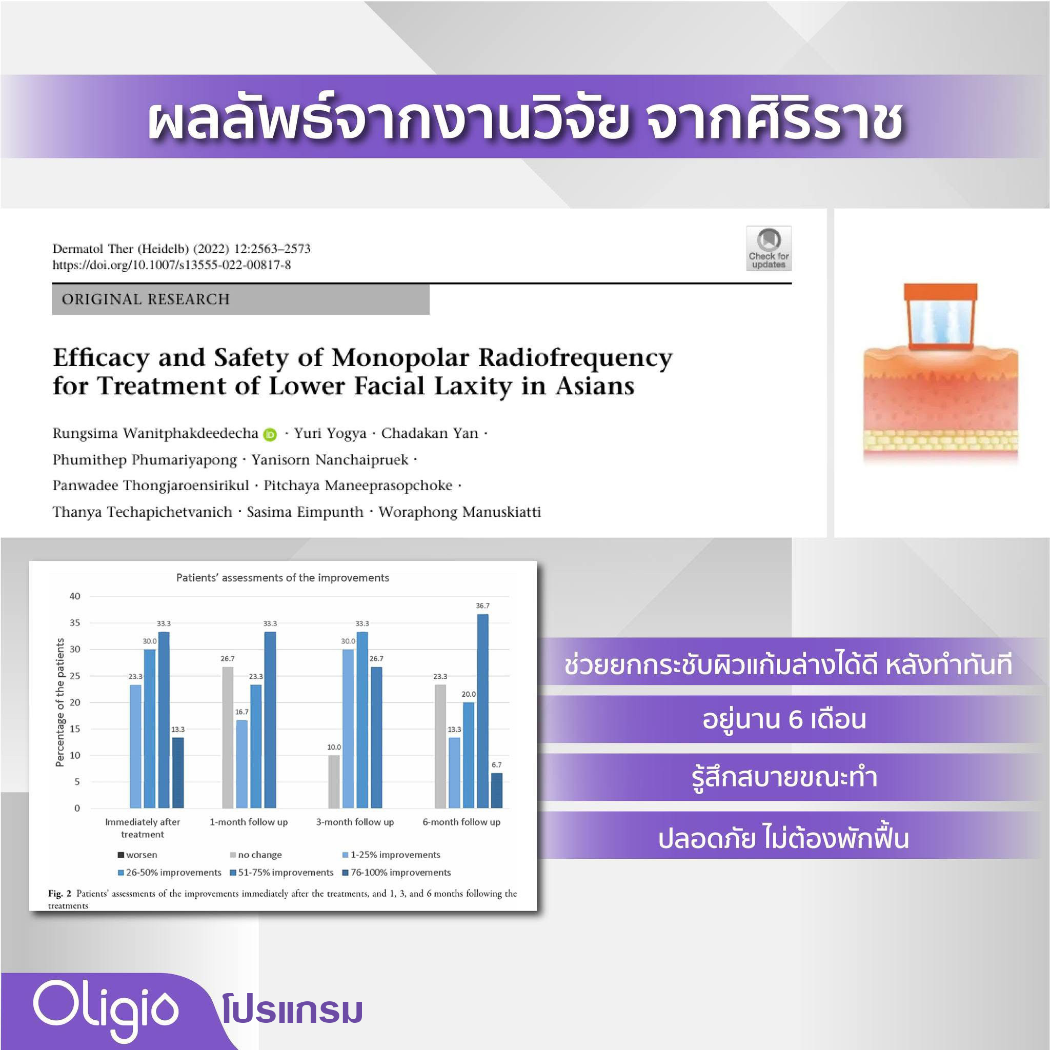 คำถามยอดฮิต นวัตกรรมกระชับผิวโปรแกรม Oligio คำถามยอดฮิต นวัตกรรมกระชับผิวโปรแกรม Oligio