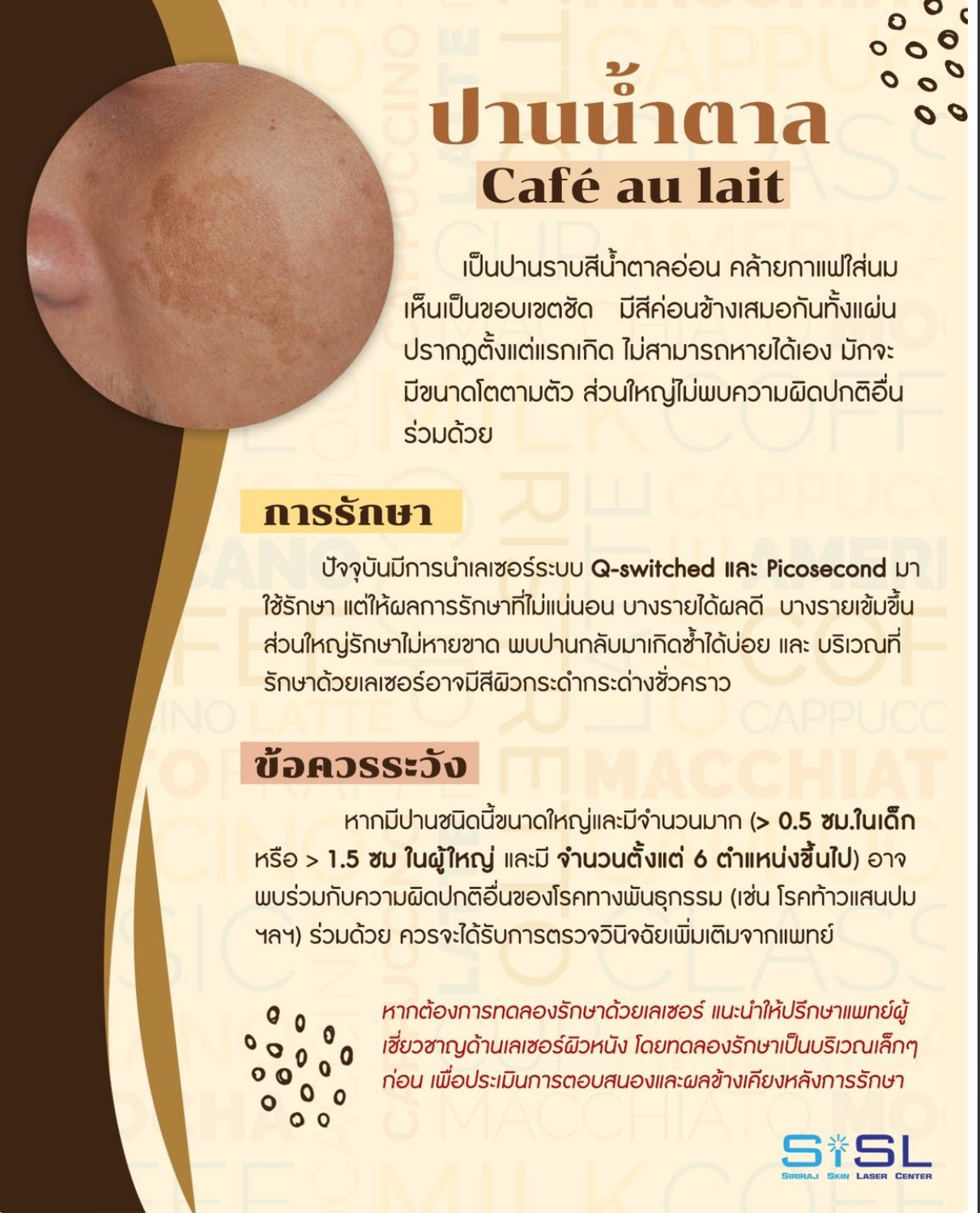 ปานสีกาแฟใส่นม (Café au lait) มีลักษณะอย่างไร? & ดูแลได้อย่างไร ?