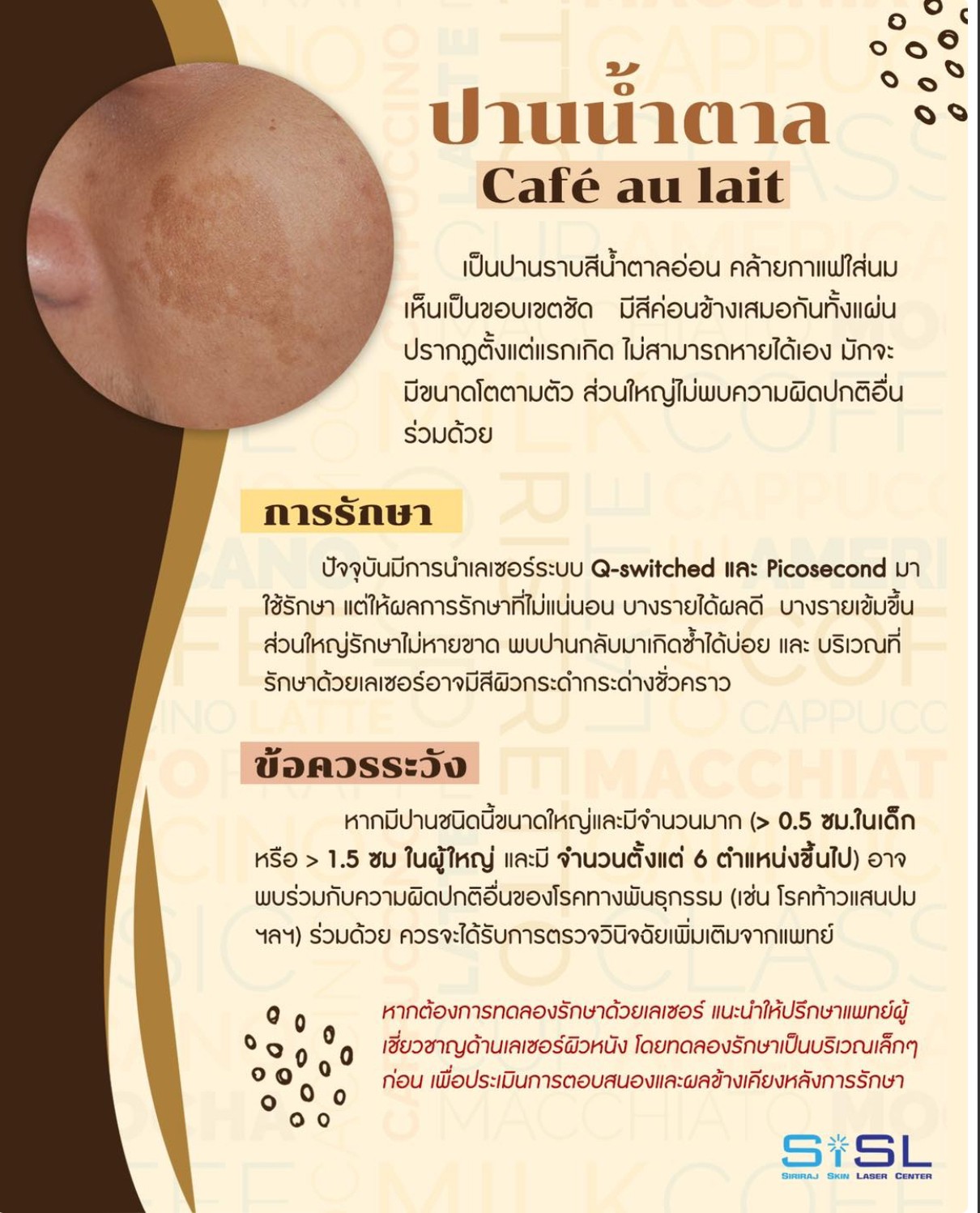 ปานสีกาแฟใส่นม (Café au lait) มีลักษณะอย่างไร? & ดูแลได้อย่างไร ? ปานสีกาแฟใส่นม (Café au lait) มีลักษณะอย่างไร? & ดูแลได้อย่างไร ?