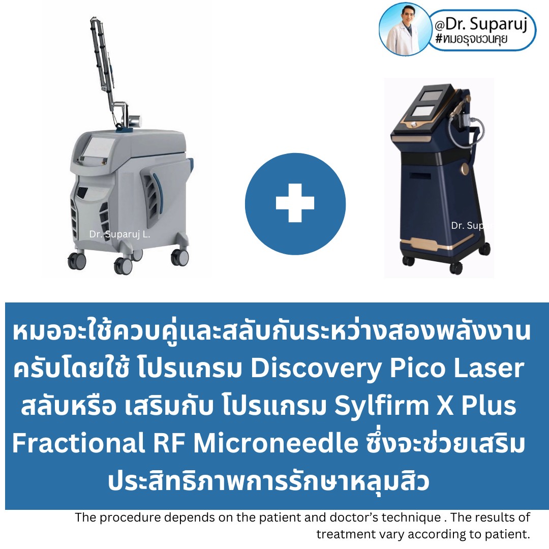 เทคนิคโปรแกรมรักษาหลุมสิว ที่หมอใช้บ่อยครับ เทคนิคโปรแกรมรักษาหลุมสิว ที่หมอใช้บ่อยครับ
