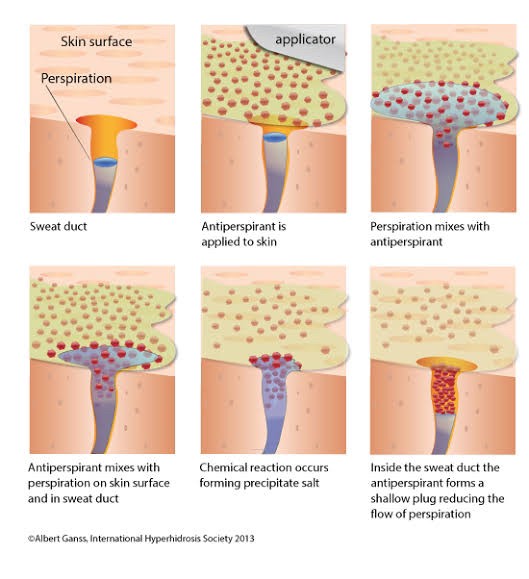 แนะนำเทคนิคดูแลโรคผิวหนัง: ภาวะเหงื่อออกมาก (Hyperhidrosis) คืออะไร & ดูแลได้อย่างไร?