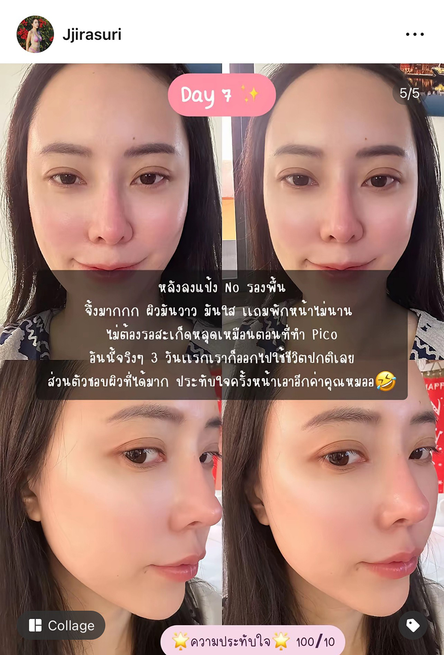 วันนี้คุณหมอแนะนำให้ยิงตัว โปรแรกม SylfirmX plus หลังจากที่เรายิงโปรแกรม Pico มาหลายรอบหลายหัว 555 ของใหม่แบบนี้คุณหมอว่าดี หนูก็เอาค่ะ วันนี้คุณหมอแนะนำให้ยิงตัว โปรแรกม SylfirmX plus หลังจากที่เรายิงโปรแกรม Pico มาหลายรอบหลายหัว 555 ของใหม่แบบนี้คุณหมอว่าดี หนูก็เอาค่ะ