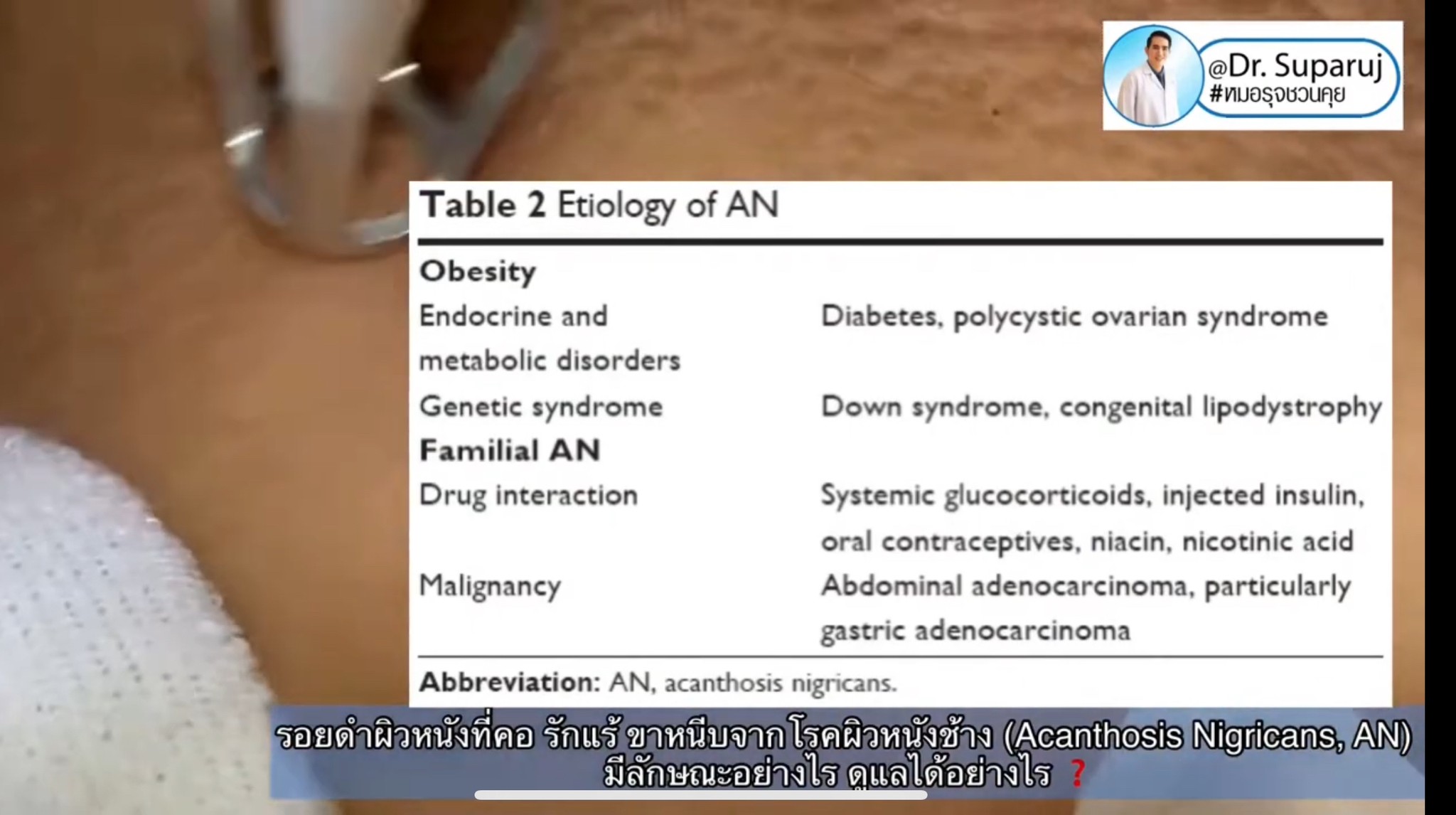 รักแร้ดำเกิดจากสาเหตุอะไร & ดูแลอย่างไร ?