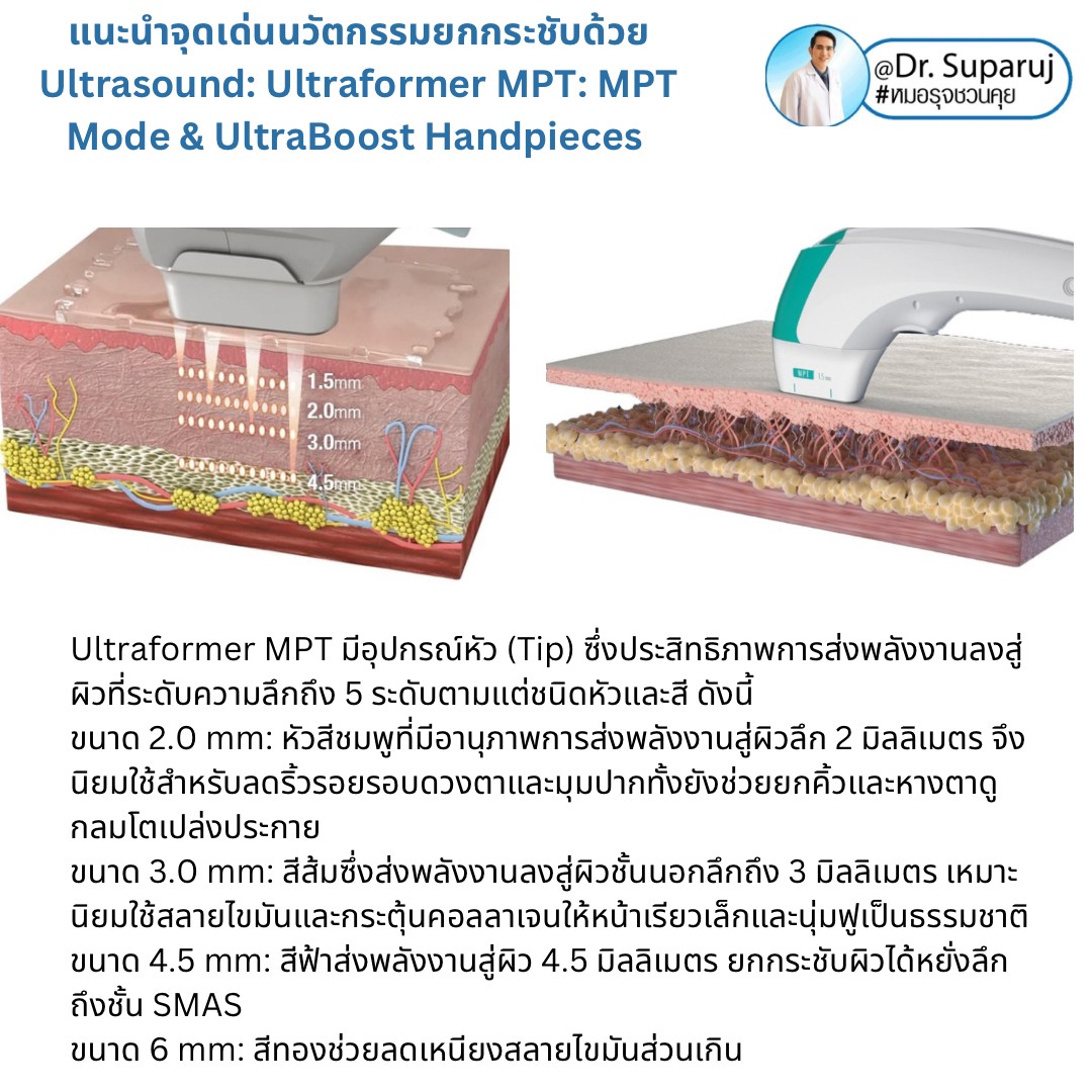 แนะนำนวัตกรรม พลังงานเครื่องเสียง Macro & Micro Focused Ultrasound ยกกระชับผิว Ultraformer MPT: จุดเด่น + ทดสอบลักษณะพลังงาน + การประเมินลักษณะผิว ให้เห็นกันชัดๆเลยครับ แนะนำนวัตกรรม พลังงานเครื่องเสียง Macro & Micro Focused Ultrasound ยกกระชับผิว Ultraformer MPT: จุดเด่น + ทดสอบลักษณะพลังงาน + การประเมินลักษณะผิว ให้เห็นกันชัดๆเลยครับ