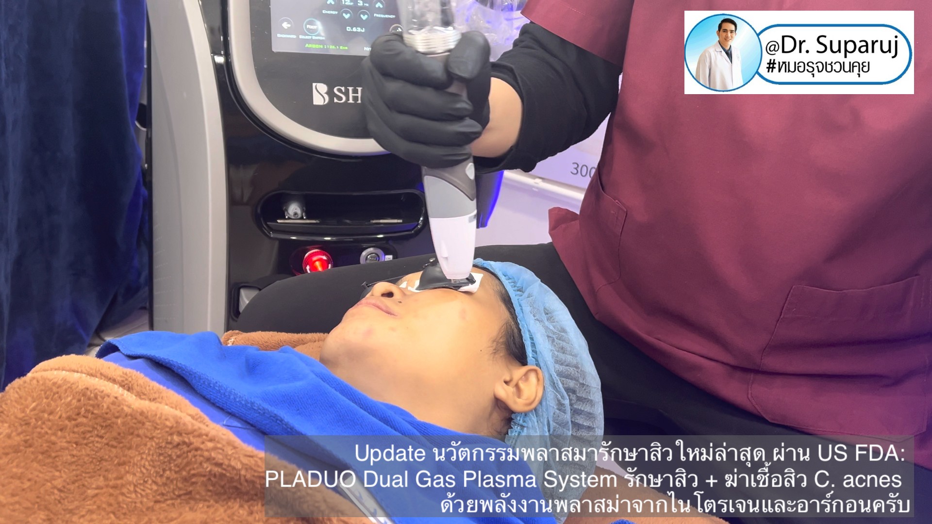 Update นวัตกรรมพลาสมารักษาสิวใหม่ล่าสุด ผ่าน US FDA: PLADUO Dual Gas Plasma System ช่วยรักษาสิว + ฆ่าเชื้อสิว C. acnes + รักษาหลุมสิว รอยดำ รอยแดง