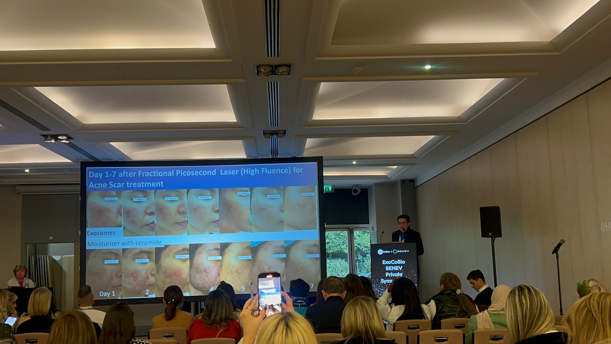 หมอรุจ ผศ. นพ. ศุภะรุจ เลื่องอรุณ ได้รับเกียรติเชิญให้เป็นวิทยากรในการประชุมทางด้านผิวหนังและศัลยกรรมตกแต่งระดับนานาชาติ ที่ใหญ่ที่สุดในโลก IMCAS World Congress 2024 ซึ่งปีนี้การประชุมจัดขึ้นที่ ศูนย์ประชุม Le Palais Des Congres (Paris) กรุงปารีส ที่ประเทศฝรั่งเศส หมอรุจ ผศ. นพ. ศุภะรุจ เลื่องอรุณ ได้รับเกียรติเชิญให้เป็นวิทยากรในการประชุมทางด้านผิวหนังและศัลยกรรมตกแต่งระดับนานาชาติ ที่ใหญ่ที่สุดในโลก IMCAS World Congress 2024 ซึ่งปีนี้การประชุมจัดขึ้นที่ ศูนย์ประชุม Le Palais Des Congres (Paris) กรุงปารีส ที่ประเทศฝรั่งเศส