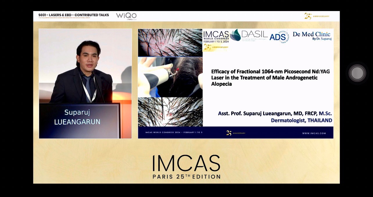 หมอรุจ ผศ. นพ. ศุภะรุจ เลื่องอรุณ ได้รับเกียรติเชิญให้เป็นวิทยากรในการประชุมทางด้านผิวหนังและศัลยกรรมตกแต่งระดับนานาชาติ ที่ใหญ่ที่สุดในโลก IMCAS World Congress 2024 ซึ่งปีนี้การประชุมจัดขึ้นที่ ศูนย์ประชุม Le Palais Des Congres (Paris) กรุงปารีส ที่ประเทศฝรั่งเศส หมอรุจ ผศ. นพ. ศุภะรุจ เลื่องอรุณ ได้รับเกียรติเชิญให้เป็นวิทยากรในการประชุมทางด้านผิวหนังและศัลยกรรมตกแต่งระดับนานาชาติ ที่ใหญ่ที่สุดในโลก IMCAS World Congress 2024 ซึ่งปีนี้การประชุมจัดขึ้นที่ ศูนย์ประชุม Le Palais Des Congres (Paris) กรุงปารีส ที่ประเทศฝรั่งเศส