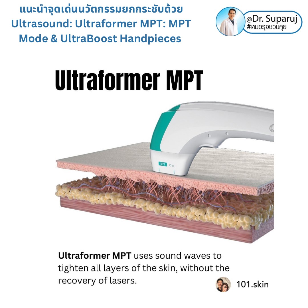 แนะนำนวัตกรรม พลังงานเครื่องเสียง Macro & Micro Focused Ultrasound ยกกระชับผิว Ultraformer MPT: จุดเด่น + ทดสอบลักษณะพลังงาน + การประเมินลักษณะผิว ให้เห็นกันชัดๆเลยครับ แนะนำนวัตกรรม พลังงานเครื่องเสียง Macro & Micro Focused Ultrasound ยกกระชับผิว Ultraformer MPT: จุดเด่น + ทดสอบลักษณะพลังงาน + การประเมินลักษณะผิว ให้เห็นกันชัดๆเลยครับ