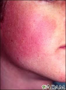 ขนคุดที่มีสีแดง KP Rubra มีลักษณะอย่างไร & ดูแลได้อย่างไร?  ขนคุดที่มีสีแดง KP Rubra มีลักษณะอย่างไร & ดูแลได้อย่างไร?