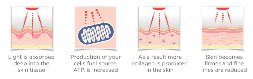 โปรแกรม PORA COOL + Skin Radiant Treatment โพล่าร์คูล + สกินเรเดียน ทรีทเมนท์ หน้ากระจ่างใส ลดการอักเสบของผิว ลดสิว โปรแกรม PORA COOL + Skin Radiant Treatment โพล่าร์คูล + สกินเรเดียน ทรีทเมนท์ หน้ากระจ่างใส ลดการอักเสบของผิว ลดสิว