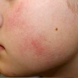 ขนคุดที่มีสีแดง KP Rubra มีลักษณะอย่างไร & ดูแลได้อย่างไร?  ขนคุดที่มีสีแดง KP Rubra มีลักษณะอย่างไร & ดูแลได้อย่างไร?