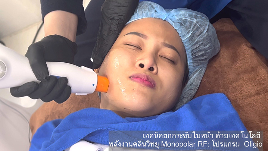 โปรแกรม Oligio การประเมินและการรักษา โปรแกรม Oligio การประเมินและการรักษา