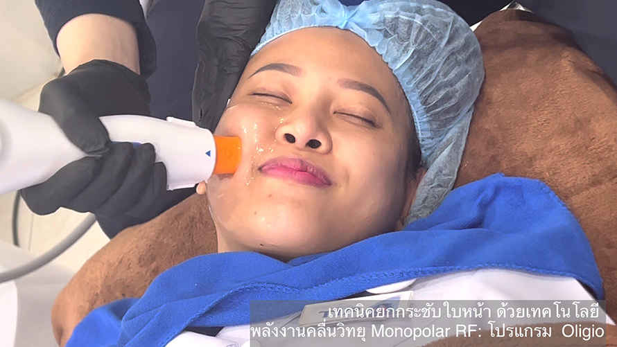 โปรแกรม Oligio การประเมินและการรักษา โปรแกรม Oligio การประเมินและการรักษา