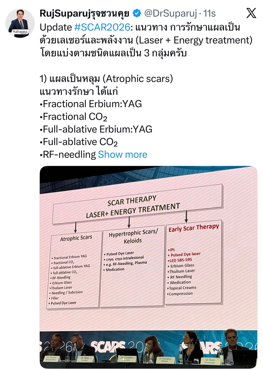 Update SCAR2026: แนวทาง การรักษาแผลเป็น ด้วยเลเซอร์และพลังงาน (Laser + Energy treatment) โดยแบ่งตามชนิดแผลเป็น 3 กลุ่มครับ Update SCAR2026: แนวทาง การรักษาแผลเป็น ด้วยเลเซอร์และพลังงาน (Laser + Energy treatment) โดยแบ่งตามชนิดแผลเป็น 3 กลุ่มครับ