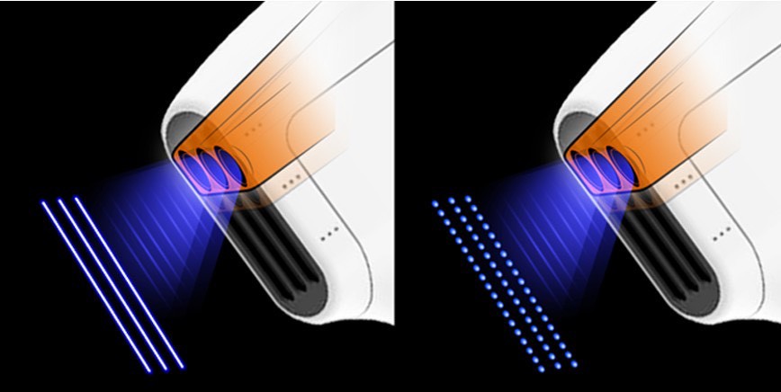 เทคนิค ยกกระชับใบหน้าและคิ้วด้วย เทคนิค Triple-Lined Multifocused Ultrasound